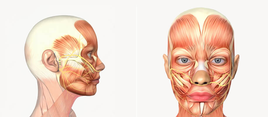 How is Cross Facial Nerve Graft Procedure Done?