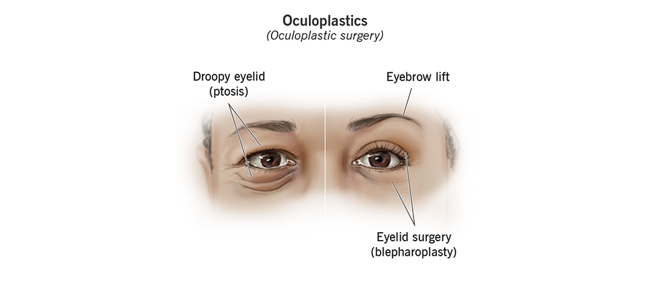oculoplastics-surgery.png (118 KB)