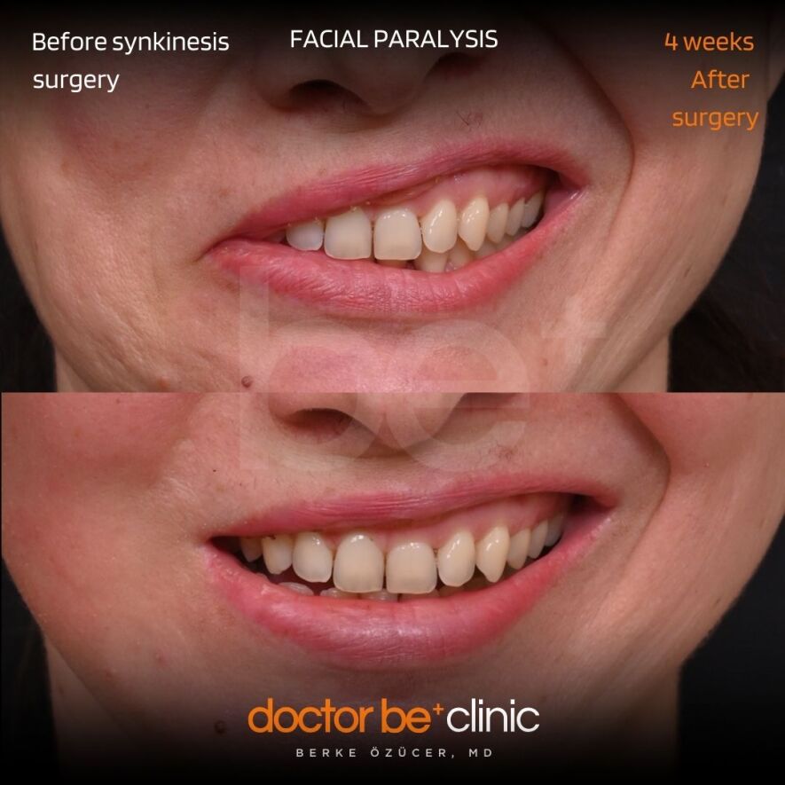 Case #3 - s.a. fotoğrafı eksik